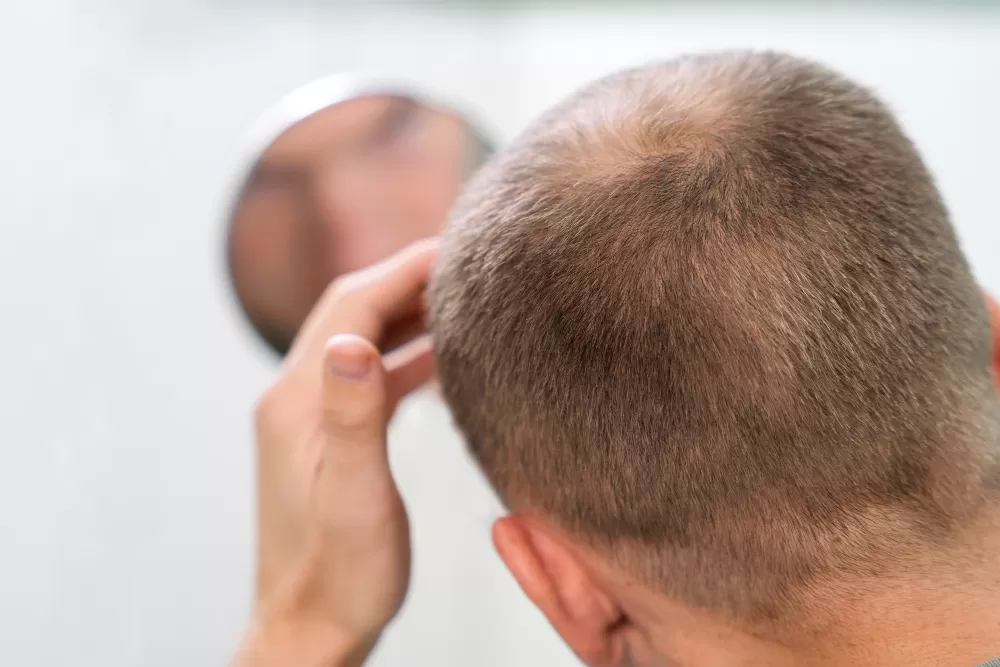 Hair Transplant Crusting: Is It Normal, What Should Be Done?
